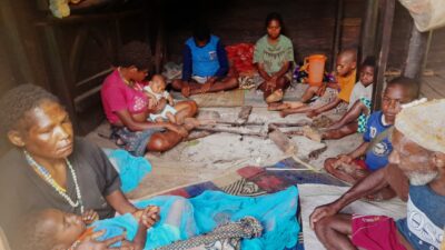 15 sterbende Kinder unter fünf Jahre in Mapia Dogiyai wurden verdächtigt, die Masern zu haben